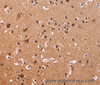 Immunohistochemistry of paraffin-embedded Human brain tissue using CSNK1D Polyclonal Antibody at dilution 1:50