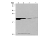 Western Blot analysis of Human fetal liver tissue and 293T cell, Human liver cancer tissue and hela cell using PPIB Polyclonal Antibody at dilution of 1:500