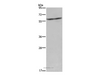 Western Blot analysis of Mouse liver tissue using CYP4A11 Polyclonal Antibody at dilution of 1:250
