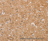Immunohistochemistry of paraffin-embedded Human brain  using CYP4A11 Polyclonal Antibody at dilution of 1:30