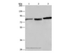 Western Blot analysis of Mouse brain tissue, A172 and Hela cell using DBH Polyclonal Antibody at dilution of 1:200