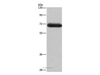 Western Blot analysis of Mouse brain tissue using DPYSL3 Polyclonal Antibody at dilution of 1:350
