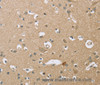Immunohistochemistry of paraffin-embedded Human brain  using ECHS1 Polyclonal Antibody at dilution of 1:35