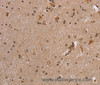 Immunohistochemistry of paraffin-embedded Human brain  tissue using EIF3H Polyclonal Antibody at dilution 1:40
