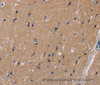 Immunohistochemistry of paraffin-embedded Human brain  tissue using KCNJ11 Polyclonal Antibody at dilution 1:40