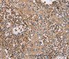 Immunohistochemistry of paraffin-embedded Human tonsil tissue using FAIM2 Polyclonal Antibody at dilution 1:40