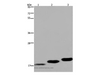 Western Blot analysis of Mouse skeletal muscle, heart and bladder tissue   using MYL12B Polyclonal Antibody at dilution of 1:450