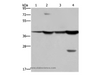 Western Blot analysis of Mouse stomach and Human fetal liver tissue, MCF-7 cell and Mouse liver tissue using FBP1 Polyclonal Antibody at dilution of 1:850