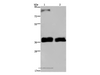 Western Blot analysis of 231 and A172 cell using FETUB Polyclonal Antibody at dilution of 1:700