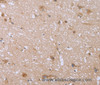Immunohistochemistry of paraffin-embedded Human brain  using FHL2 Polyclonal Antibody at dilution of 1:40