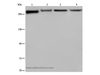 Western Blot analysis of PC3, Hela, NIH/3T3 and HUVEC cell using FLNA Polyclonal Antibody at dilution of 1:800