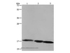 Western Blot analysis of Raji cell, Mouse liver and heart tissue using FIS1 Polyclonal Antibody at dilution of 1:500