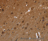 Immunohistochemistry of paraffin-embedded Human brain  using FRK Polyclonal Antibody at dilution of 1:50