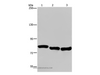 Western Blot analysis of A549, Hela and K562 cell using GAB2 Polyclonal Antibody at dilution of 1:300