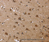 Immunohistochemistry of paraffin-embedded Human brain  tissue using GADD45B Polyclonal Antibody at dilution 1:30