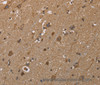 Immunohistochemistry of paraffin-embedded Human brain  using GALK1 Polyclonal Antibody at dilution of 1:40