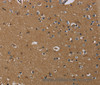 Immunohistochemistry of paraffin-embedded Human brain  tissue using GBP5 Polyclonal Antibody at dilution 1:40