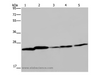 Western Blot analysis of Mouse spleen tissue, A375, A549, HT-29 and Hela cell using ARHGDIA Polyclonal Antibody at dilution of 1:350