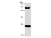 Western Blot analysis of Human fetal liver tissue using GGT1 Polyclonal Antibody at dilution of 1:300