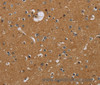 Immunohistochemistry of paraffin-embedded Human brain tissue using Glucocorticoid Receptor Polyclonal Antibody at dilution 1:40