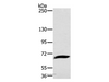 Western Blot analysis of Mouse liver tissue using CD42b Polyclonal Antibody at dilution of 1:800