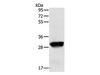 Western Blot analysis of Human liver cancer tissue using GSTO1 Polyclonal Antibody at dilution of 1:200