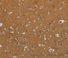 Immunohistochemistry of paraffin-embedded Human brain using CSH1 Polyclonal Antibody at dilution of 1:40