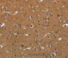 Immunohistochemistry of paraffin-embedded Human brain  using HSD17B2 Polyclonal Antibody at dilution of 1:50