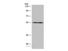 Western Blot analysis of A549 cell using IMPDH2 Polyclonal Antibody at dilution of 1:650
