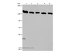 Western Blot analysis of Hela cell and Human testis tissue, A549, Jurkat and K562 cell using IPO4 Polyclonal Antibody at dilution of 1:550