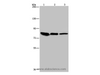 Western Blot analysis of Mouse skin tissue, HUVEC and Hela cell using Catenin gamma Polyclonal Antibody at dilution of 1:850