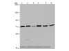 Western Blot analysis of K562, A549, HT-29, 293T, Hela and Jurkat cell using KARS Polyclonal Antibody at dilution of 1:350