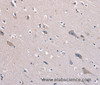 Immunohistochemistry of paraffin-embedded Human brain  tissue using KCNQ5 Polyclonal Antibody at dilution 1:60