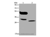 Western Blot analysis of A375 cell and Human lung cancer tissue using MAGEA8 Polyclonal Antibody at dilution of 1:400