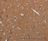Immunohistochemistry of paraffin-embedded Human brain  tissue using MAGEB10 Polyclonal Antibody at dilution 1:60