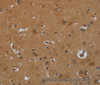 Immunohistochemistry of paraffin-embedded Human brain  tissue using ENTPD7 Polyclonal Antibody at dilution 1:60