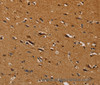 Immunohistochemistry of paraffin-embedded Human brain  tissue using CENPU Polyclonal Antibody at dilution 1:30