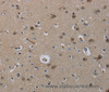 Immunohistochemistry of paraffin-embedded Human brain  using MRE11 Polyclonal Antibody at dilution of 1:60