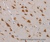 Immunohistochemistry of paraffin-embedded Human brain  tissue using CMC4 Polyclonal Antibody at dilution 1:55