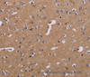 Immunohistochemistry of paraffin-embedded Human brain  tissue using NDUFA1 Polyclonal Antibody at dilution 1:30