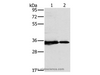 Western Blot analysis of 231 and Jurkat cell using NDUFAF1 Polyclonal Antibody at dilution of 1:500