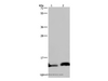 Western Blot analysis of Human hepatocellular carcinoma and fetal brain tissue using NDUFA5 Polyclonal Antibody at dilution of 1:400