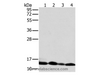 Western Blot analysis of Human liver tissue and K562 cell, Human fetal brain tissue and Raji cell using NDUFS5 Polyclonal Antibody at dilution of 1:400