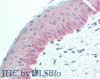 Immunohistochemistry of paraffin-embedded Human Skin using NECTIN4 Polyclonal Antibody at dilution of 1:90(Elabscience® Product Detected by Lifespan).