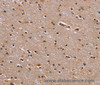 Immunohistochemistry of paraffin-embedded Human brain using GNL3 Polyclonal Antibody at dilution of 1:60