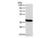 Western Blot analysis of Mouse liver tissue using OTC Polyclonal Antibody at dilution of 1:800