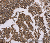 Immunohistochemistry of paraffin-embedded Human tonsil using OTC Polyclonal Antibody at dilution of 1:50