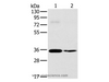 Western Blot analysis of 293T and skov3 cell using OTUB1 Polyclonal Antibody at dilution of 1:570