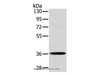 Western Blot analysis of A172 cell using CLP36 Polyclonal Antibody at dilution of 1:400