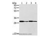 Western Blot analysis of K562 cell and Human liver cancer tissue, Jurkat and A549 cell using PNMT Polyclonal Antibody at dilution of 1:400